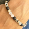 peau acné bracelet